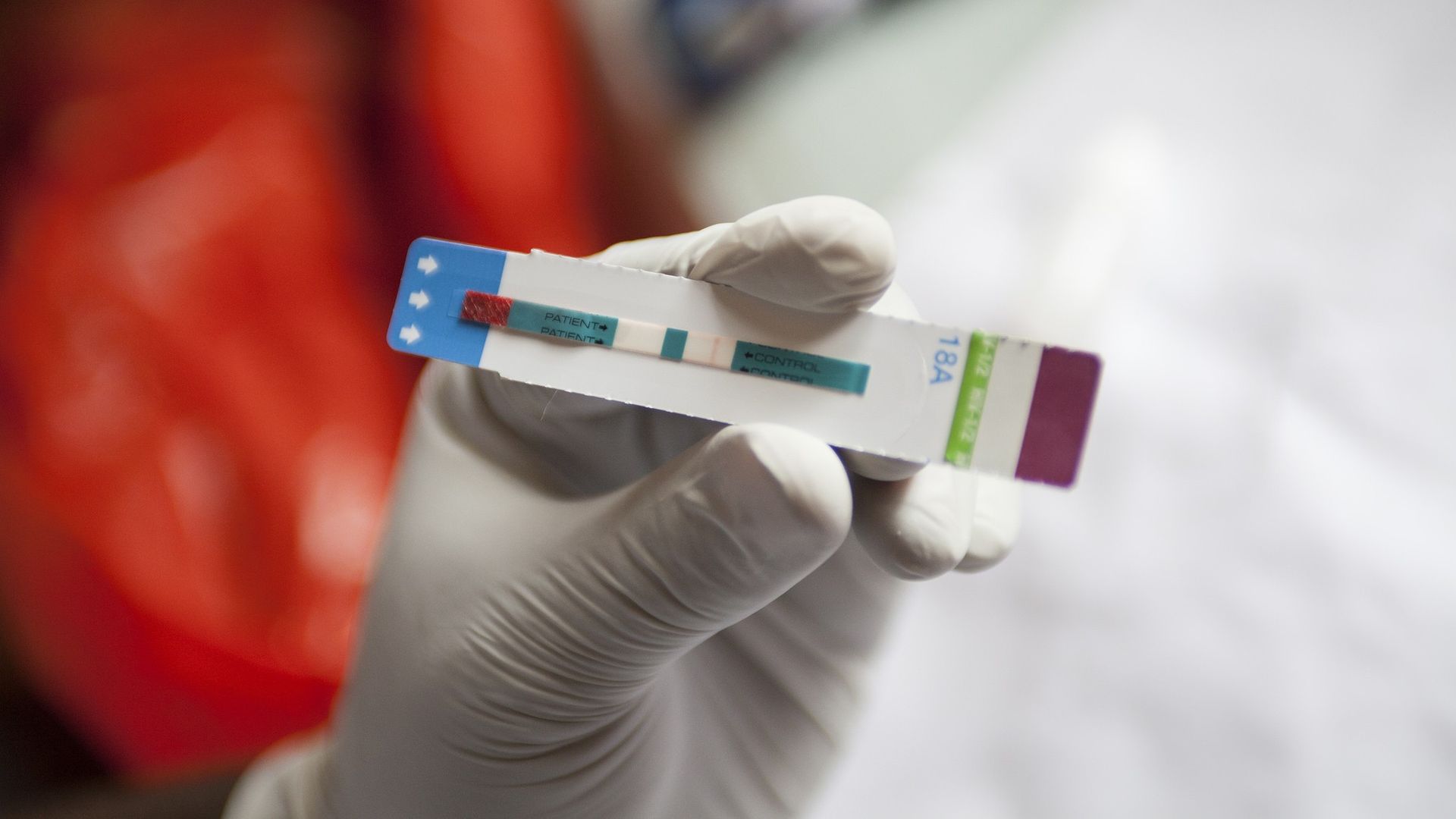 TakeMeHome HIV Test Kits Critical In Ending HIV Epidemic In The US